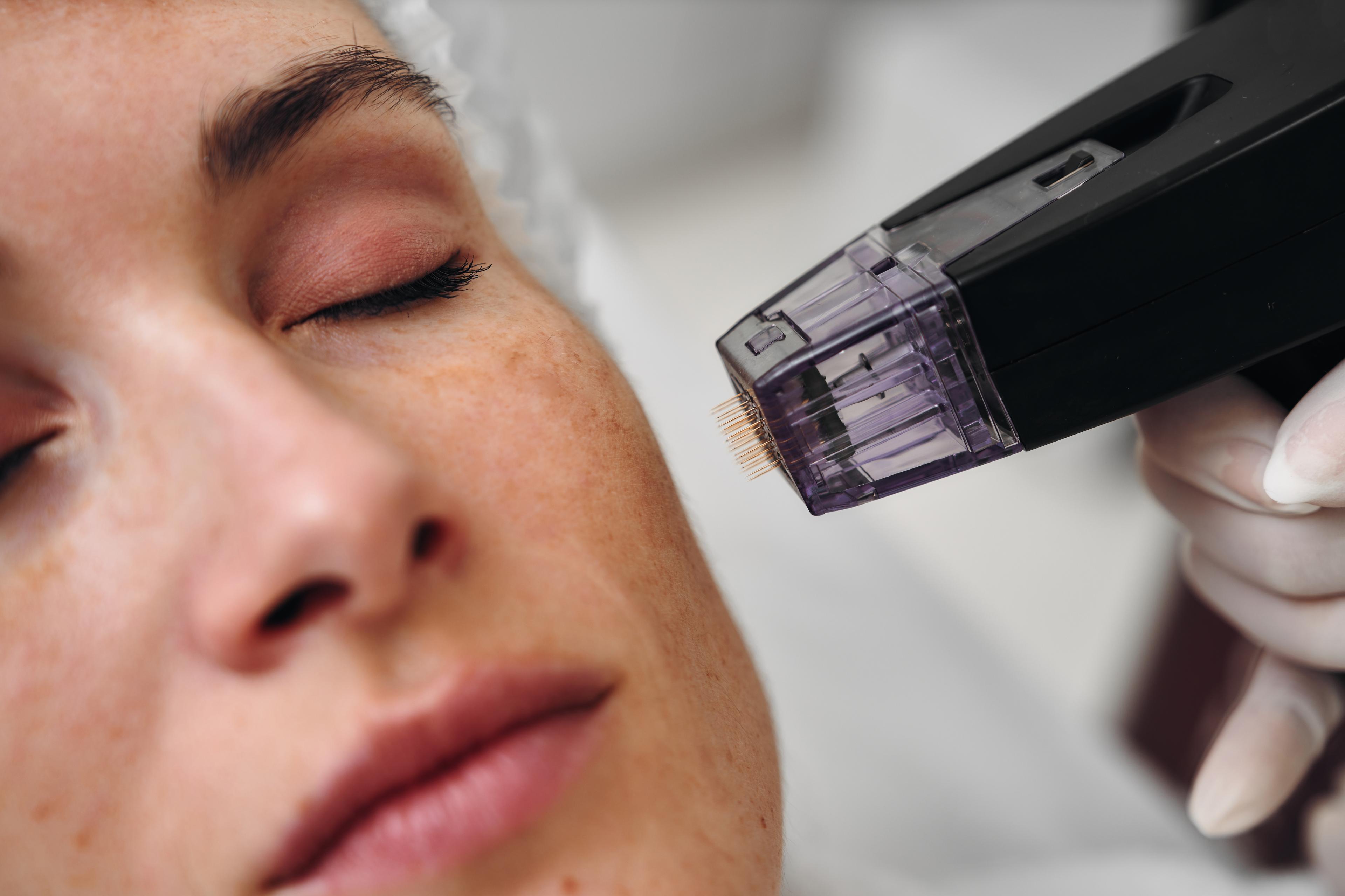 Facial and skin treatment at Lumora Belle Beauty, Loughborough