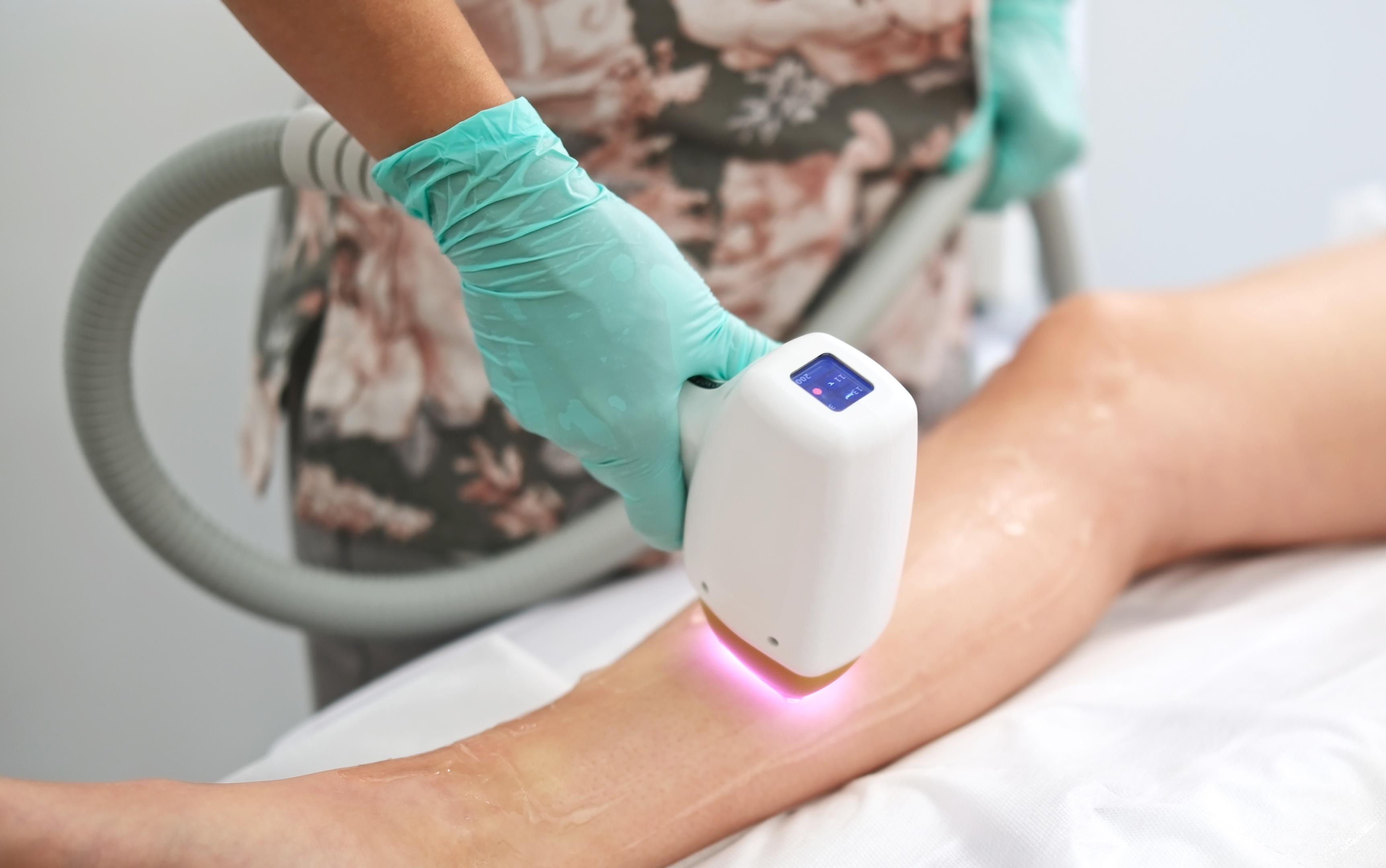Laser hair removal gel application at Lumora Belle Beauty, Loughborough